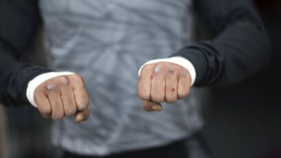 Studije pokazuju da je “bare knuckle”manje štetan po zdravlje od boksa i MMA-ja!